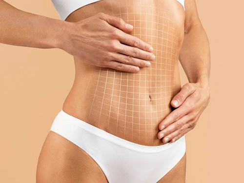 Karın Germe (Abdominoplasti)